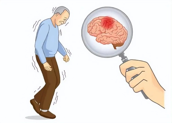 警惕身体的红色警报，脑中风先兆症状是什么